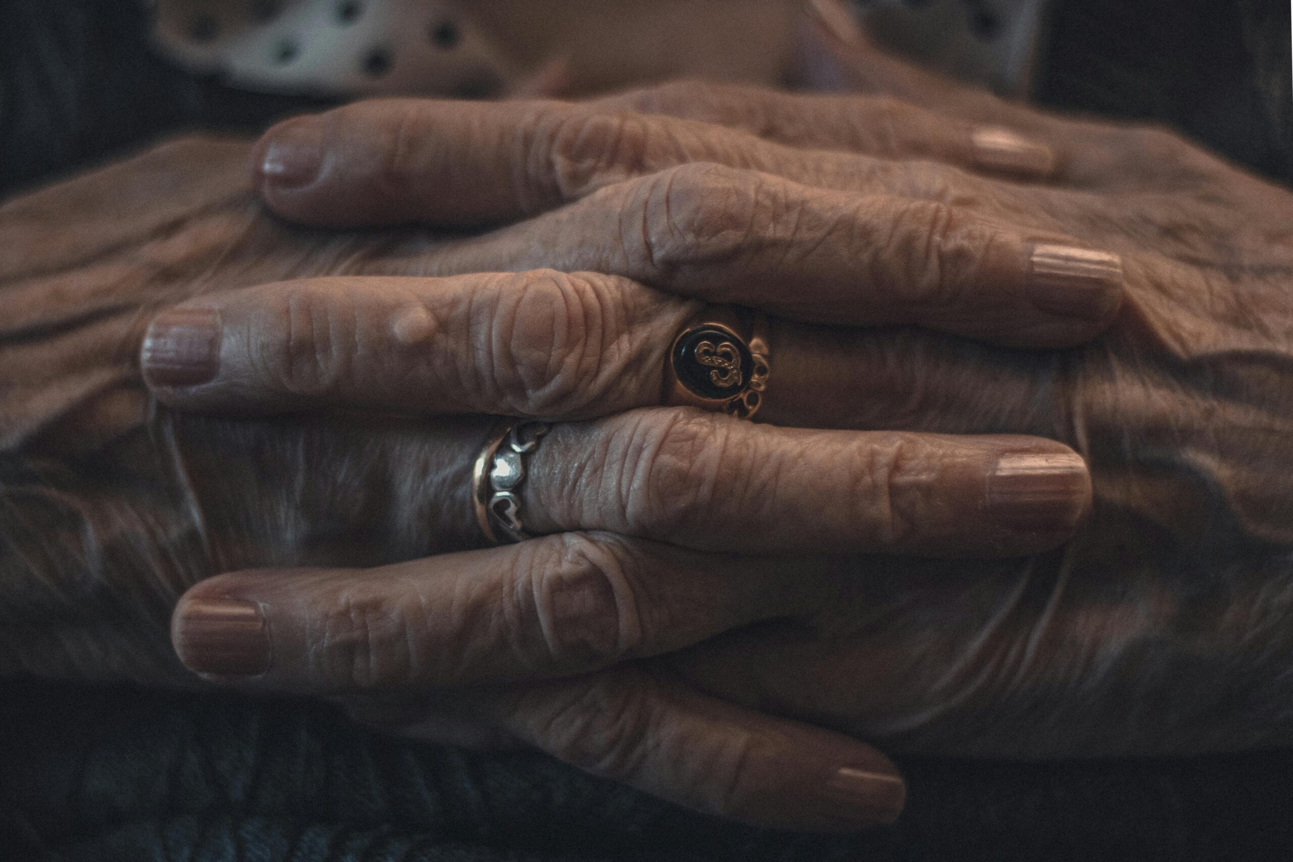 Person clasping hands with arthritis