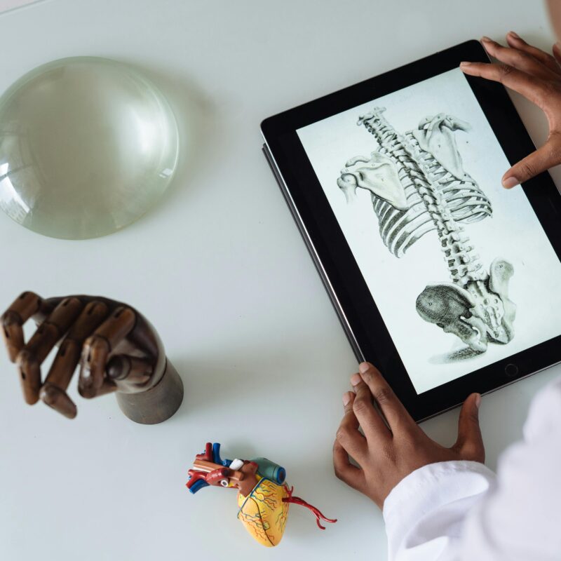 Doctor looking at picture of a spine